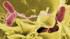 Cảnh giác với dịch bệnh sau mưa lũ