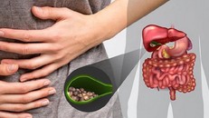 Bệnh sỏi mật và những biến chứng nguy hiểm không thể chủ quan