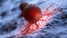 Phát hiện “công tắc ẩn” khiến khối u kháng điều trị ung thư