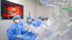 Các bác sỹ Bệnh viện K thực hiện một ca phẫu thuật bằng robot. 