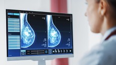 Trí tuệ nhân tạo: Hệ thống AI hỗ trợ phát hiện sớm ung thư vú