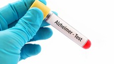Bộ xét nghiệm máu mới giúp phát hiện sớm bệnh Alzheimer