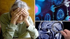 Dấu hiệu cảnh báo nguy cơ sa sút trí tuệ