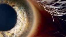 Mắt bionic – cơ hội mới cho những người mù do bị chấn thương 