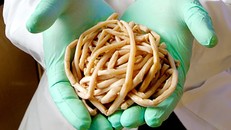 Rùng mình với những loại kí sinh trùng trong cơ thể người