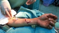 2 kẻ bịt mặt đâm bé gái 12 tuổi trong đêm Noel