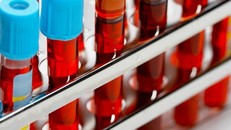 Phát hiện mới về nhóm máu và nguy cơ bệnh tật