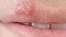 Cả công ty lo sốt vó vì nữ thực tập mắc bệnh xã hội