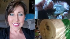 Bé trai 19 tháng suýt chết vì túi silicon độn ngực của mẹ nhiễm nấm