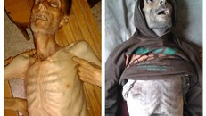 Nạn đói biến người dân Syria thành “những bộ xương khô”