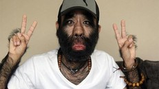 5 bộ phận 'không nên tồn tại' trên cơ thể người