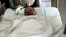 Thiếu nữ xinh đẹp bị người yêu cũ tạt xăng châm lửa đốt