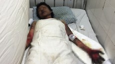 Đôi nam nữ cháy đen trong phòng trọ: Xuất hiện tình tiết bất ngờ