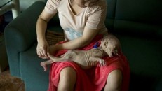 Đáng sợ căn bệnh biến trẻ thành cụ già