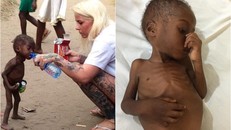 Đau lòng nhìn bé trai 2 tuổi suýt chết đói vì bị cho là phù thủy