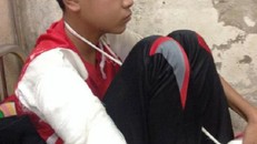 Vụ thầy giáo đánh học sinh nhập viện: Sự bất nhất trong kết luận