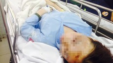 Vụ 2 nữ sinh bị tạt axit: Nạn nhân bỏng 75% mặt, mù 1 mắt