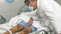 Hà Nội: Phát hiện ca nhiễm não mô cầu đầu tiên, cách ly 27 người