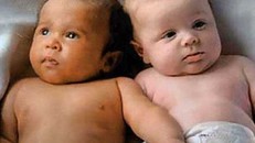 Cặp song sinh khác cha ở Hòa Bình: Có thể quan hệ kiểu 'tập thể' 