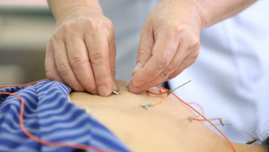 Các bệnh nhân được sử dụng phương pháp Điện châm tại Bệnh viện Y học cổ truyền tỉnh Lạng Sơn. 