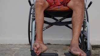 Chủ động ứng phó nguy cơ bệnh bại liệt xâm nhập Việt Nam