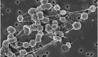 Phát hiện cơ chế giúp sinh vật “chịu nhiệt” sống sót trong môi trường khắc nghiệt