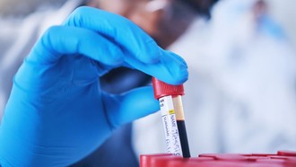 Chỉ cần xét nghiệm máu có thể dự báo sớm bệnh tim di truyền phổ biến nhất thế giới