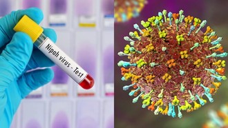 Cảnh giác với virus Nipah nhưng người dân không nên quá hoang mang