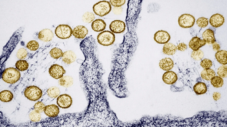 Những điều cần biết về virus Hanta