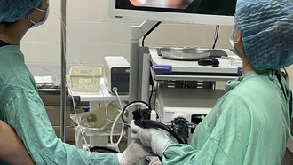 Nội soi cứu người nuốt ba bàn chải đánh răng