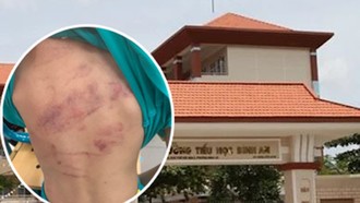 Trường Tiểu học Bình An và học sinh lớp 1 bị bạn đánh (ảnh nhỏ).
