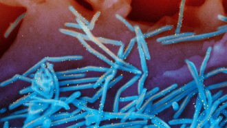 Mỹ: Gia hạn tiêm chủng cho trẻ em do diễn biến dịch RSV phức tạp