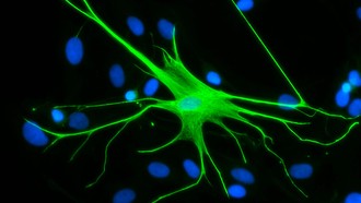 Điều trị sang chấn và lo âu bằng tế bào não