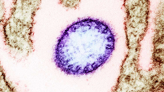 Những rào cản khiến virus Nipah chưa có vaccine