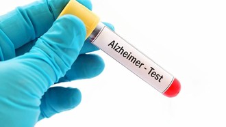 Bộ xét nghiệm máu mới giúp phát hiện sớm bệnh Alzheimer