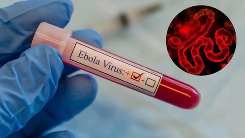 Quốc tế khẩn cấp tăng viện trợ giúp CHDC Congo chống Ebola