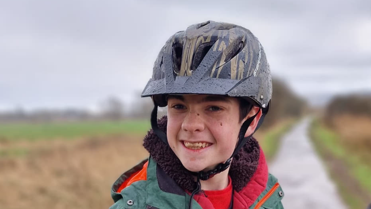 Ca cấy ghép não để kiểm soát cơn động kinh đầu tiên trên thế giới. Ảnh: supplied