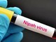 Philippines cảnh báo người dân về virus Nipah