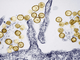Những điều cần biết về virus Hanta