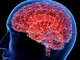 Yếu tố gây tiến triển bệnh Alzheimer