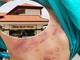 Vết thương của học sinh lớp 1 do bị bạn bạo hành và trường Tiểu học Bình An (ảnh nhỏ).