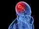 Xét nghiệm di truyền xác định loại khối u não trong chưa đầy 2 giờ