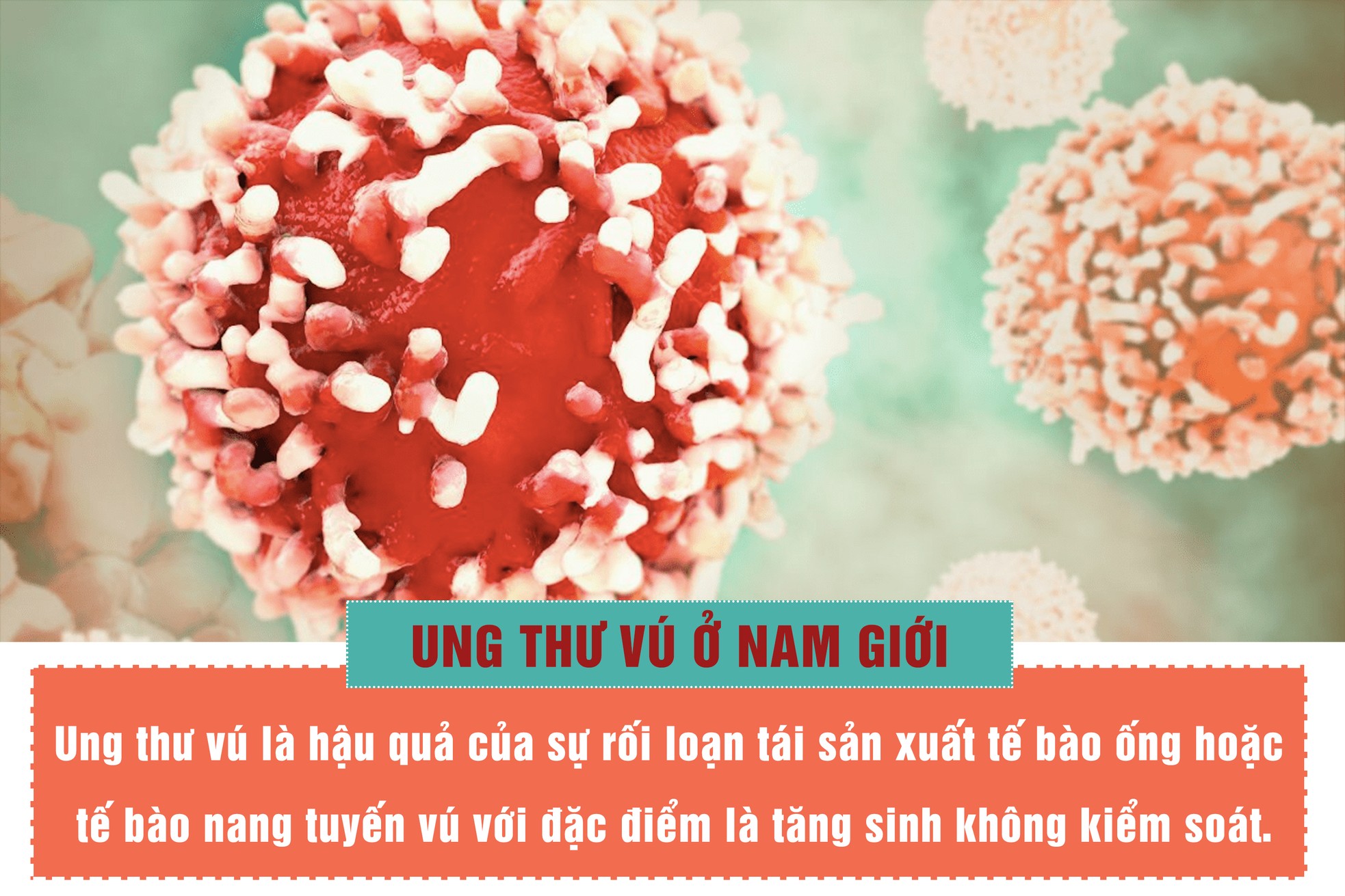 Nam giới đừng bỏ qua khi thấy khối u dưới ngực ảnh 3