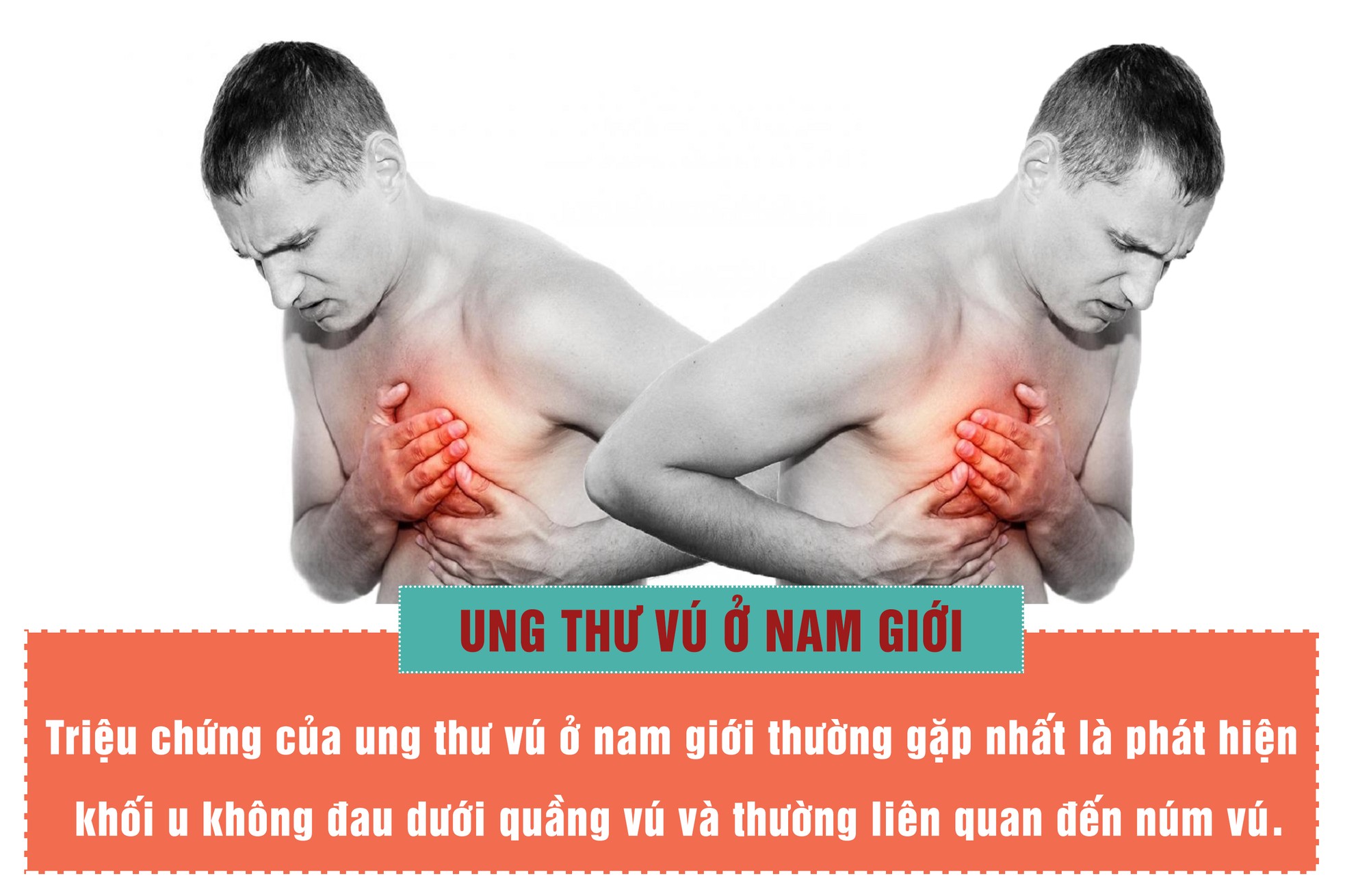 Nam giới đừng bỏ qua khi thấy khối u dưới ngực ảnh 5