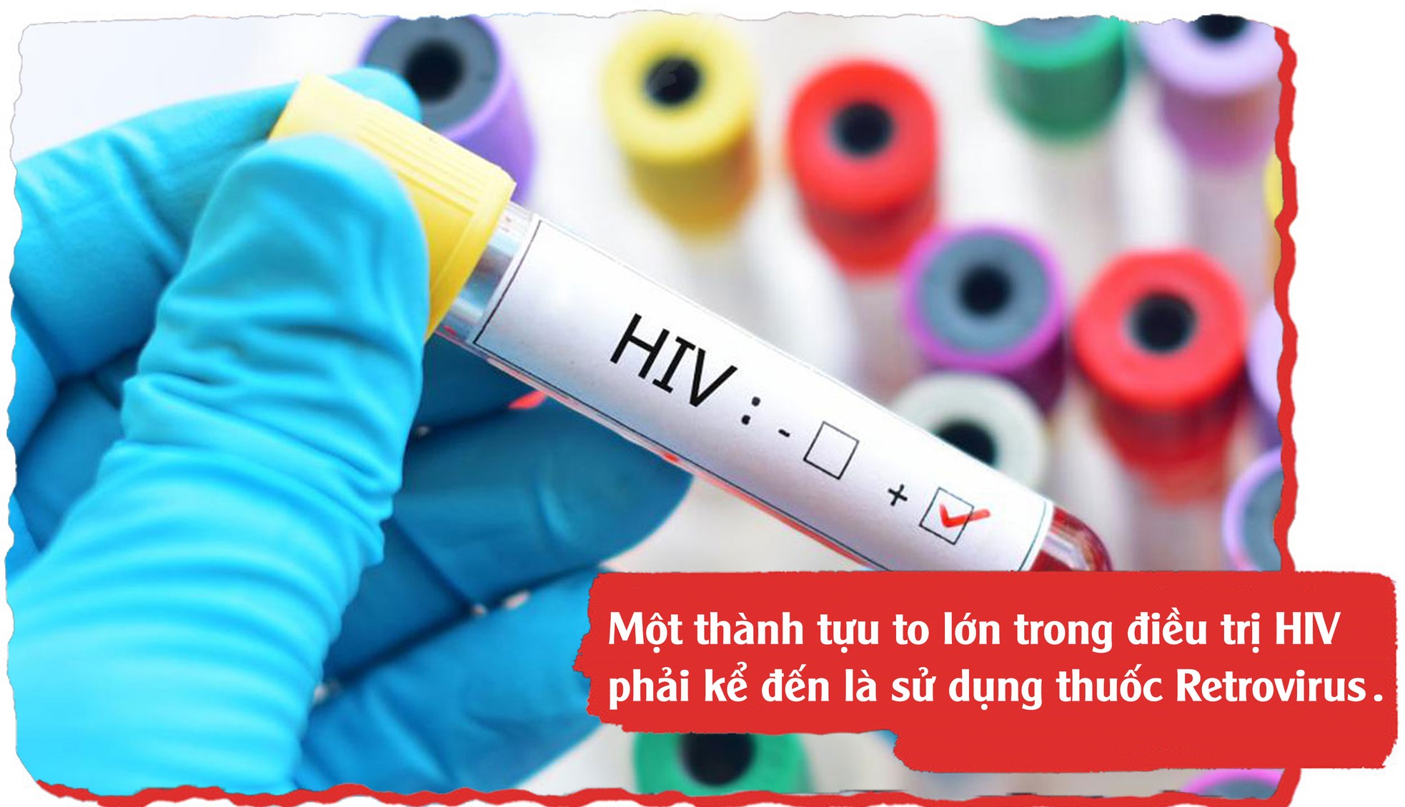 Cuộc chiến chống HIV trên toàn cầu ảnh 7