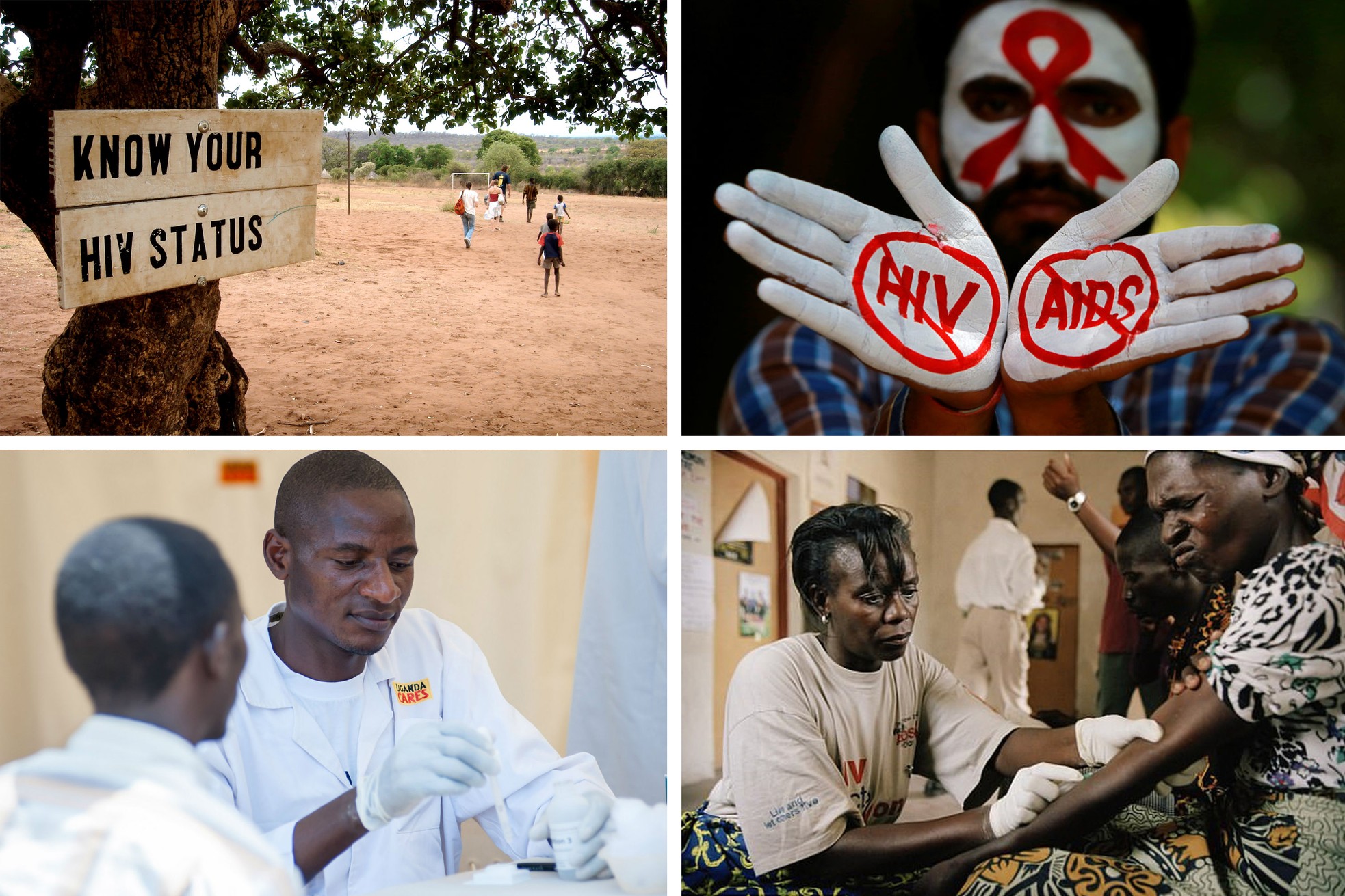 Cuộc chiến chống HIV trên toàn cầu ảnh 3