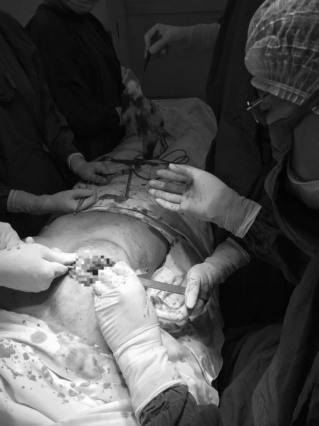 Nâng ngực, sửa mũi: Đẹp chốc lát, khổ cả đời - ảnh 1