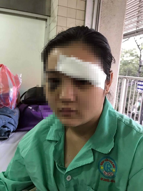 Đang bán trà sữa thiếu nữ bị giang hồ lao vào cắt tai - ảnh 2