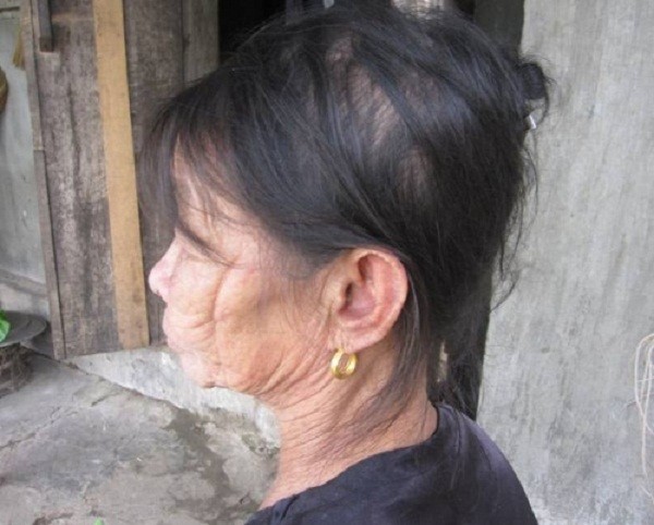 Cắt gân tay vợ vì dám vay tiền làm đám cưới (1) - ảnh 2