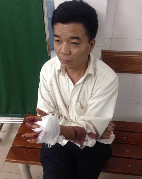 Chủ tịch HĐQT trường Lômônôxốp chém bảo vệ trọng thương - ảnh 3